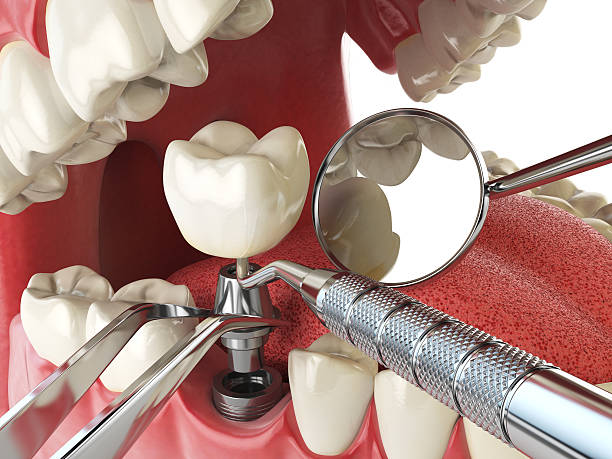 Best Knocked-Out Tooth Emergency  in Chilton, WI